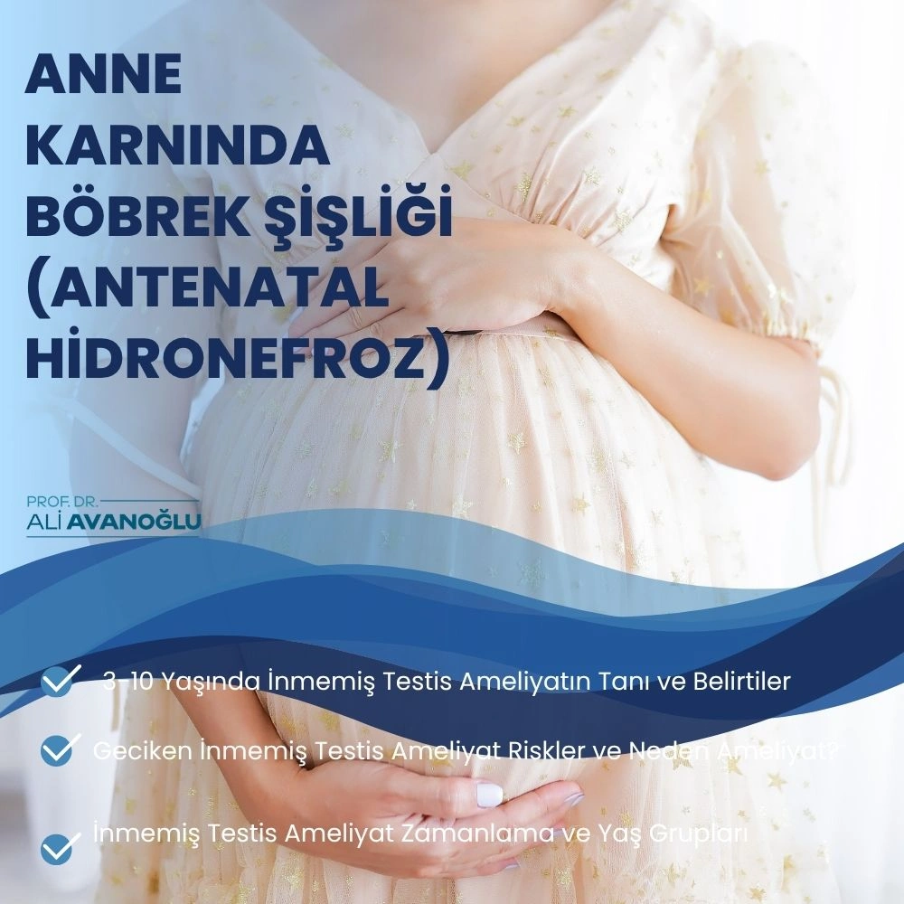 Anne Karnında Böbrek Şişliği (Antenatal Hidronefroz): UP Darlığı mı, VUR mu, Yoksa Kendiliğinden Geçer mi?
