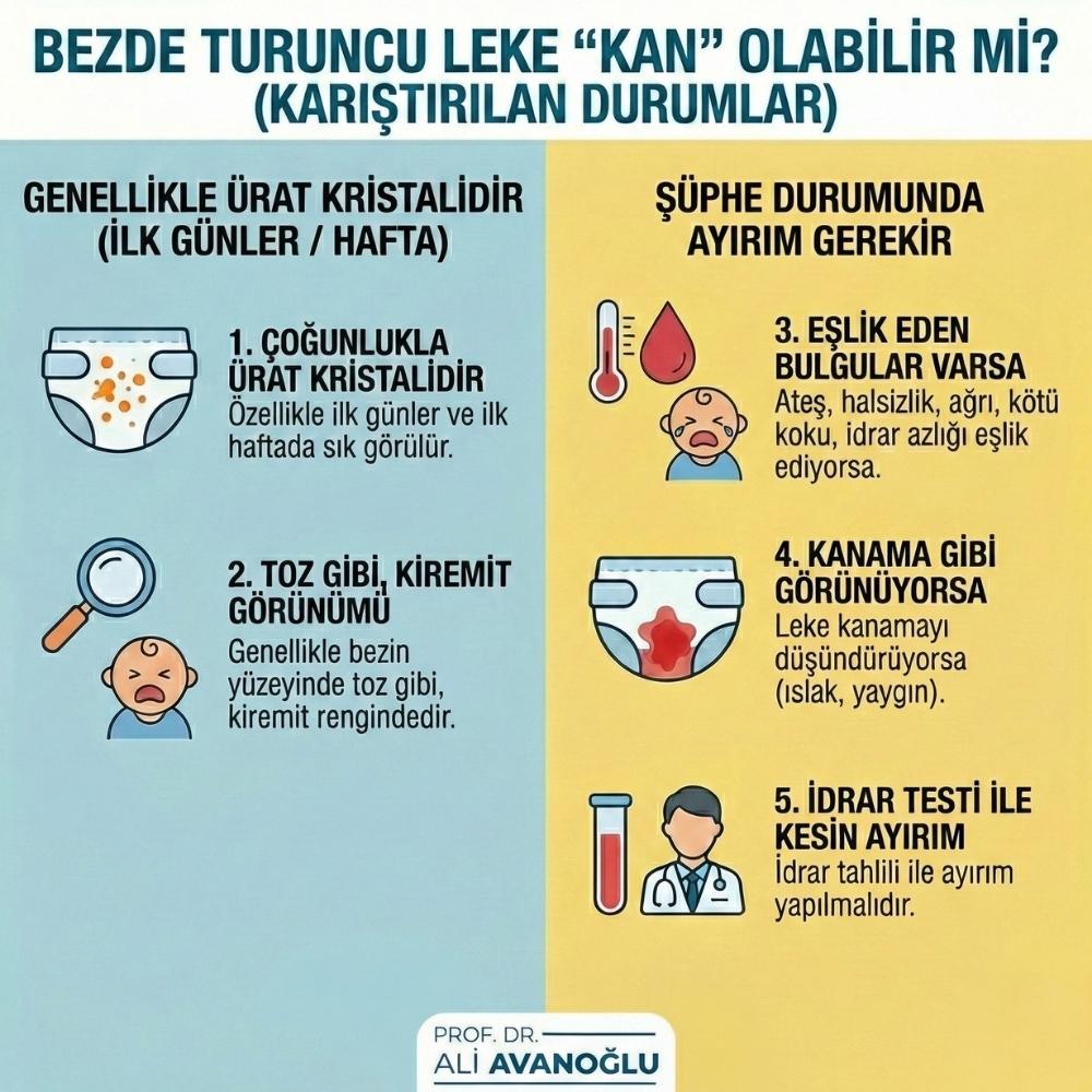 Bebek bezinde turuncu leke Kadınlar Kulübü