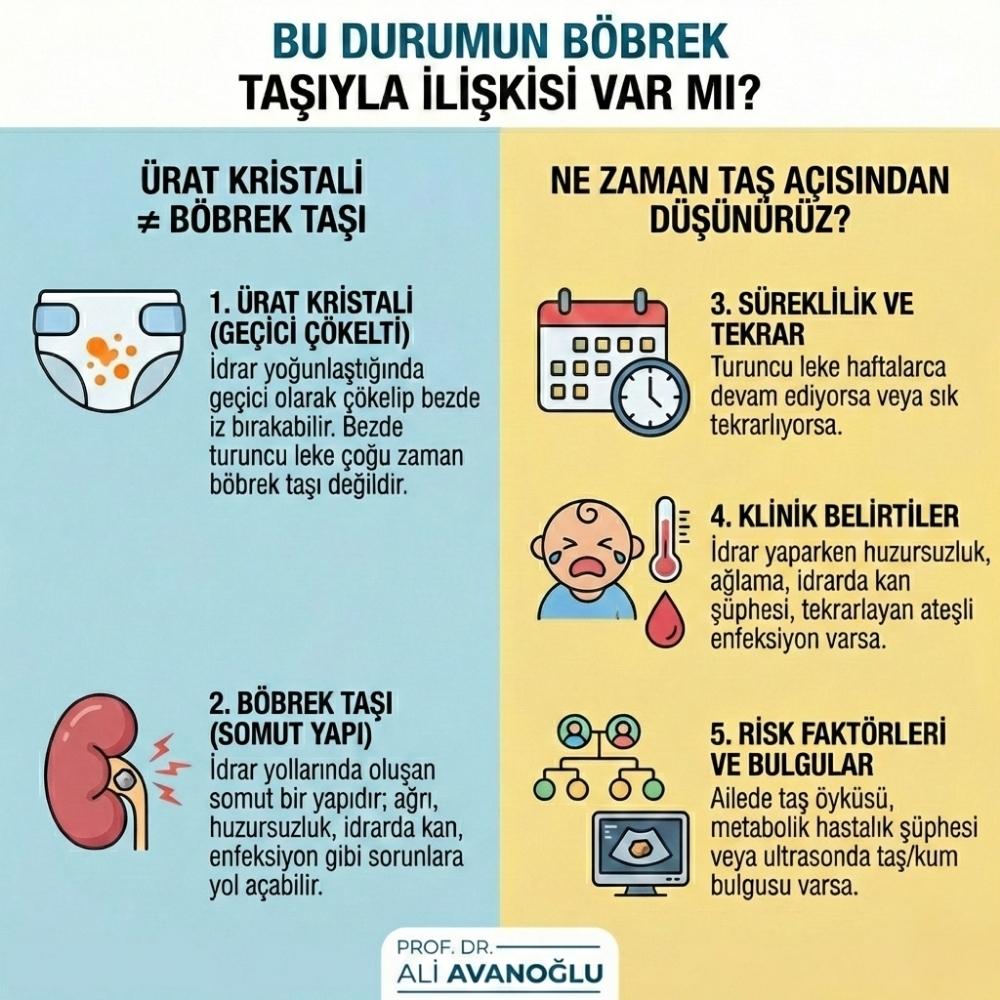 Bebeklerde Böbrek Taşı nasıl düşer